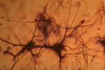 ph020 Deux neuronnes ph020 Deux neuronnes