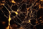 ph022 Neurones marqués à la toxine tétanique ph022 Neurones marqués à la toxine tétanique