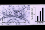 ph025 Complexe synaptique avec vésicules ph025 Complexe synaptique avec vésicules